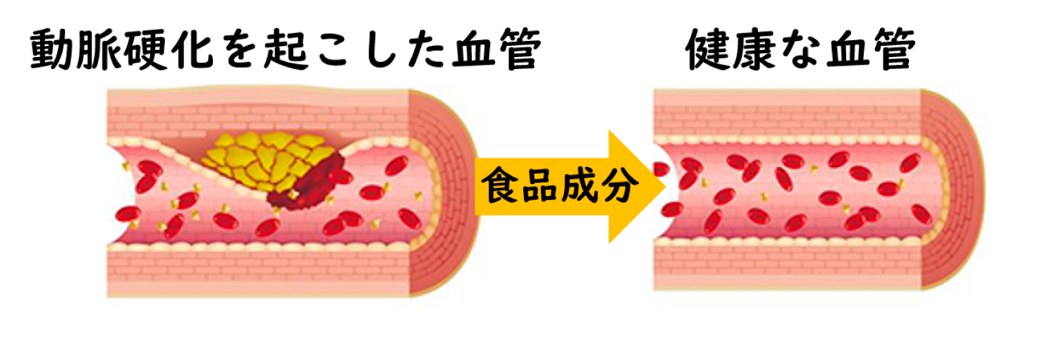 動脈硬化を起こした血管→食品成分→健康な血管